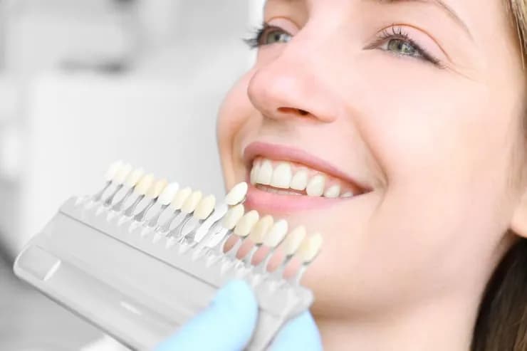 Ceramic Veneers in Surat